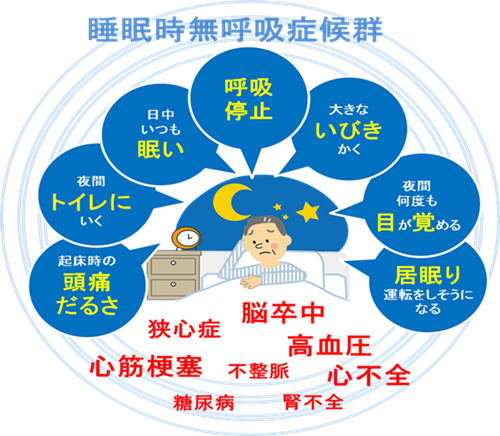 睡眠時無呼吸症候群01